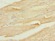 Immunohistochemistry of paraffin-embedded human skeletal muscle tissue using CSB-PA004460DSR2HU at dilution of 1:100