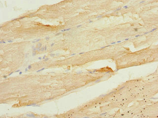 Immunohistochemistry of paraffin-embedded human skeletal muscle tissue using CSB-PA004460DSR2HU at dilution of 1:100