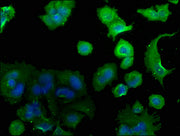 Immunofluorescence staining of MCF-7 cells with CSB-PA004470NA01HU at 1:50, counter-stained with DAPI. The cells were fixed in 4% formaldehyde, permeabilized using 0.2% Triton X-100 and blocked in 10% normal Goat Serum. The cells were then incubat...