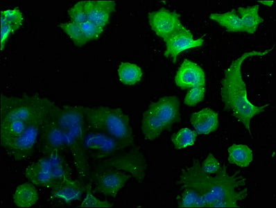 Immunofluorescence staining of MCF-7 cells with CSB-PA004470NA01HU at 1:50, counter-stained with DAPI. The cells were fixed in 4% formaldehyde, permeabilized using 0.2% Triton X-100 and blocked in 10% normal Goat Serum. The cells were then incubat...