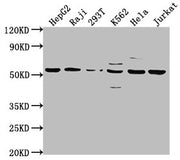 Western Blot Positive WB detected in: HepG2 whole cell lysate, Raji whole cell lysate, 293T whole cell lysate, K562 whole cell lysate, Hela whole cell lysate, Jurkat whole cell lysate All lanes: CAP1 antibody at 1:2000 Secondary Goat polyclonal to...