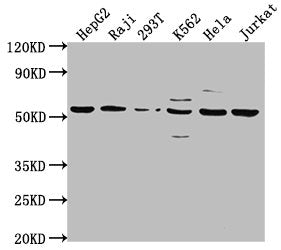 Western Blot Positive WB detected in: HepG2 whole cell lysate, Raji whole cell lysate, 293T whole cell lysate, K562 whole cell lysate, Hela whole cell lysate, Jurkat whole cell lysate All lanes: CAP1 antibody at 1:2000 Secondary Goat polyclonal to...