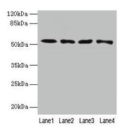 Western blot All lanes: CAP2 antibody at 4µg/ml Lane 1: HepG2 whole cell lysate Lane 2: Mouse muscle tissue Lane 3: Mouse gonadal tissue Lane 4: Hela whole cell lysate Secondary Goat polyclonal to rabbit IgG at 1/10000 dilution Predicted band size...