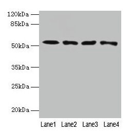 Western blot All lanes: CAP2 antibody at 4µg/ml Lane 1: HepG2 whole cell lysate Lane 2: Mouse muscle tissue Lane 3: Mouse gonadal tissue Lane 4: Hela whole cell lysate Secondary Goat polyclonal to rabbit IgG at 1/10000 dilution Predicted band size...
