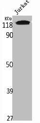Western Blot analysis of Jurkat cells using WDHD1 Polyclonal Antibody