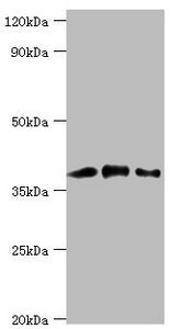 Western blot All lanes: Macrophage-capping protein antibody at 1ug/ml Lane 1: Hela whole cell lysate Lane 2: NIH/3T3 whole cell lysate Lane 3: Rat lung tissue Secondary Goat polyclonal to rabbit IgG at 1/10000 dilution Predicted band size: 39, 37...