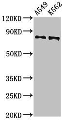 Western Blot Positive WB detected in: A549 whole cell lysat, K562 whole cell lysate All lanes: CAPN1 antibody at 2.7µg/ml Secondary Goat polyclonal to rabbit IgG at 1/50000 dilution Predicted band size: 82 kDa Observed band size: 82 kDa