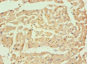 Immunohistochemistry of paraffin-embedded human heart tissue using CSB-PA004490ESR1HU at dilution of 1:100