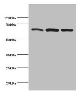 Western blot All lanes: Calpain-1 catalytic subunit antibody at 2ug/ml Lane 1: A431 whole cell lysate Lane 2: Hela whole cell lysate Lane 3: Jurkat whole cell lysate Secondary Goat polyclonal to rabbit IgG at 1/10000 dilution Predicted band size:...