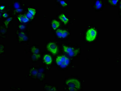 Immunofluorescence staining of MCF-7 cells with CSB-PA004490LA01HU at 1:200, counter-stained with DAPI. The cells were fixed in 4% formaldehyde, permeabilized using 0.2% Triton X-100 and blocked in 10% normal Goat Serum. The cells were then incuba...
