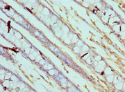 Immunohistochemistry of paraffin-embedded human colon tissue using CSB-PA004497DSR1HU at dilution of 1:100