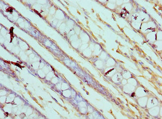 Immunohistochemistry of paraffin-embedded human colon tissue using CSB-PA004497DSR1HU at dilution of 1:100