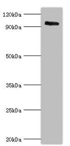 Western blot All lanes: Calpain-3 antibody at 5ug/ml + Mouse brain tissue Secondary Goat polyclonal to rabbit IgG at 1/10000 dilution Predicted band size: 95, 85, 94, 36, 19 kDa Observed band size: 95 kDa