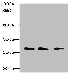 Western blot All lanes: CAPNS1 antibody at 1.15µg/ml Lane 1: Mouse lung tissue Lane 2: Mouse brain tissue Lane 3: Hela whole cell lysate Secondary Goat polyclonal to rabbit IgG at 1/10000 dilution Predicted band size: 28 kDa Observed band size: 28...