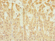 Immunohistochemistry of paraffin-embedded human adrenal gland tissue using CSB-PA004503ESR2HU at dilution of 1:100