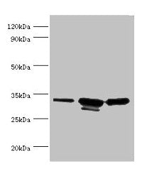 Western blot All lanes: CAPZB antibody at 6µg/ml Lane 1: 293T whole cell lysate Lane 2: A431 whole cell lysate Lane 3: Jurkat whole cell lysate Secondary Goat polyclonal to rabbit IgG at 1/10000 dilution Predicted band size: 32, 31 kDa Observed ba...