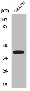 Western Blot analysis of COLO205 cells using XPA Polyclonal Antibody