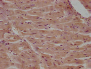 IHC image of CSB-PA004521LA01HU diluted at 1:100 and staining in paraffin-embedded human heart tissue performed on a Leica BondTM system. After dewaxing and hydration, antigen retrieval was mediated by high pressure in a citrate buffer (pH 6.0). S...