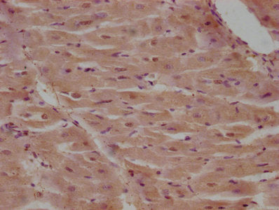 IHC image of CSB-PA004521LA01HU diluted at 1:100 and staining in paraffin-embedded human heart tissue performed on a Leica BondTM system. After dewaxing and hydration, antigen retrieval was mediated by high pressure in a citrate buffer (pH 6.0). S...