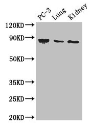 Western Blot Positive WB detected in: PC-3 whole cell lysate, Mouse lung tissue, Mouse kidney tissue All lanes: CARS antibody at 3µg/ml Secondary Goat polyclonal to rabbit IgG at 1/50000 dilution Predicted band size: 86, 83, 95 kDa Observed band s...