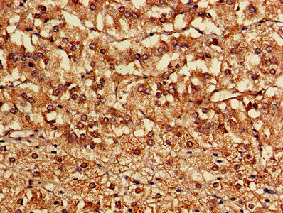 Immunohistochemistry of paraffin-embedded human adrenal gland tissue using CSB-PA004539LA01HU at dilution of 1:100