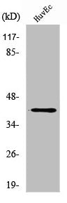 Western Blot analysis of COLO205 cells using ZADH2 Polyclonal Antibody