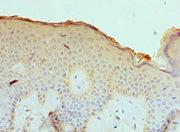 Immunohistochemistry of paraffin-embedded human skin tissue using CSB-PA004546ESR1HU at dilution of 1:100