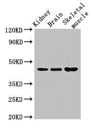 Western Blot Positive WB detected in: Mouse kidney tissue, Mouse brain tissue, Mouse skeletal muscle tissue All lanes: CASP4 antibody at 3.5ug/ml Secondary Goat polyclonal to rabbit IgG at 1/50000 dilution Predicted band size: 44, 37, 14, 31, 19 k...