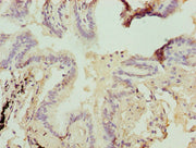 Immunohistochemistry of paraffin-embedded human lung tissue using CSB-PA00454A0Rb at dilution of 1:100