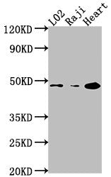 Western Blot Positive WB detected in: L02 whole cell lysate, Raji whole cell lysate, Mouse heart tissue All lanes: CASP9 antibody at 1:2000 Secondary Goat polyclonal to rabbit IgG at 1/50000 dilution Predicted band size: 47, 31, 18, 37 kDa Observe...