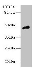 Western blot All lanes: CASQ1 antibody at 5µg/ml + Mouse brain tissue Secondary Goat polyclonal to rabbit IgG at 1/10000 dilution Predicted band size: 46 kDa Observed band size: 46 kDa