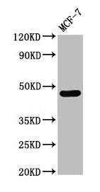Western Blot Positive WB detected in: MCF-7 whole cell lysate All lanes: CASQ2 antibody at 3µg/ml Secondary Goat polyclonal to rabbit IgG at 1/50000 dilution Predicted band size: 47, 39 kDa Observed band size: 47 kDa
