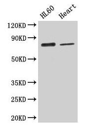 Western Blot Positive WB detected in: HL60 whole cell lysate, Mouse heart tissue All lanes: CAST antibody at 2.6µg/ml Secondary Goat polyclonal to rabbit IgG at 1/50000 dilution Predicted band size: 77, 76, 64, 72, 82, 85, 83, 75, 81 kDa Observed...