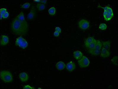 Immunofluorescence staining of MCF-7 cells with CSB-PA004571OA01HU at 1:100, counter-stained with DAPI. The cells were fixed in 4% formaldehyde, permeabilized using 0.2% Triton X-100 and blocked in 10% normal Goat Serum. The cells were then incuba...