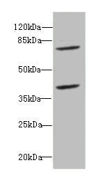 Western blot All lanes: CBFA2T2antibody at 2.45ug/ml + Raji whole cell lysate Secondary Goat polyclonal to rabbit IgG at 1/10000 dilution Predicted band size: 68, 64, 29, 66 kDa Observed band size: 68, 40 kDa