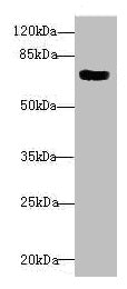 Western blot All lanes: CBFA2T2 antibody at 1.82µg/ml + 293T whole cell lysate Secondary Goat polyclonal to rabbit IgG at 1/10000 dilution Predicted band size: 68, 64, 29, 66 kDa Observed band size: 68 kDa