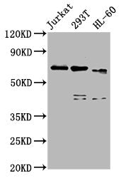 Western Blot Positive WB detected in: Jurkat whole cell lysate, 293T whole cell lysate, HL60 whole cell lysate All lanes: CBFA2T3 antibody at 5µg/ml Secondary Goat polyclonal to rabbit IgG at 1/50000 dilution Predicted band size: 72, 63, 64, 8 kDa...