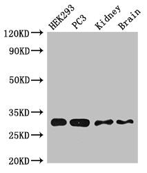 Western Blot Positive WB detected in:HEK293 whole cell lysate,PC-3 whole cell lysate,Mouse kidney tissue,Mouse brain tissue All lanes:CBR1 antibody at 2.5µg/ml Secondary Goat polyclonal to rabbit IgG at 1/50000 dilution Predicted band size: 31,19...