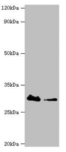 Western blot All lanes: Carbonyl reductase [NADPH] 3 antibody at 10ug/ml Lane 1: Hela whole cell lysate Lane 2: K562 whole cell lysate Secondary Goat polyclonal to rabbit IgG at 1/10000 dilution Predicted band size: 31 kDa Observed band size: 31 kDa
