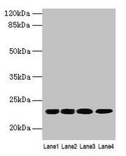 Western blot All lanes: CBX5 antibody at 9µg/ml Lane 1: K562 whole cell lysate Lane 2: MCF-7 whole cell lysate Lane 3: 293T whole cell lysate Lane 4: Hela whole cell lysate Secondary Goat polyclonal to rabbit IgG at 1/10000 dilution Predicted band...