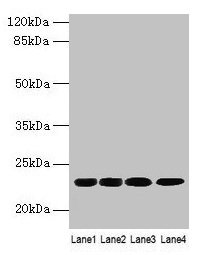 Western blot All lanes: CBX5 antibody at 9µg/ml Lane 1: K562 whole cell lysate Lane 2: MCF-7 whole cell lysate Lane 3: 293T whole cell lysate Lane 4: Hela whole cell lysate Secondary Goat polyclonal to rabbit IgG at 1/10000 dilution Predicted band...