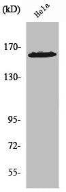 Western Blot analysis of HeLa cells using ZNF608 Polyclonal Antibody