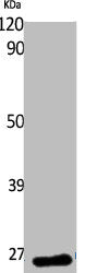 Western Blot analysis of K562 cells using EF-1β Polyclonal Antibody