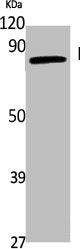 Western Blot analysis of A549 cells using ENaC γ Polyclonal Antibody