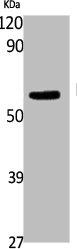 Western Blot analysis of K562 cells using FTO Polyclonal Antibody