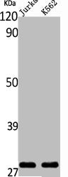 Western Blot analysis of Jurkat K562 cells using ING4 Polyclonal Antibody