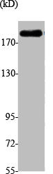 Western Blot analysis of A549 cells using Brm Polyclonal Antibody