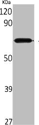 Western Blot analysis of rat kidney cells using Aladin Polyclonal Antibody