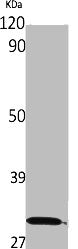 Western Blot analysis of rat stomach cells using M6A Polyclonal Antibody