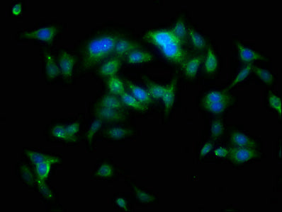 Immunofluorescence staining of HepG2 cells with CSB-PA00465A0Rb at 1:100, counter-stained with DAPI. The cells were fixed in 4% formaldehyde, permeabilized using 0.2% Triton X-100 and blocked in 10% normal Goat Serum. The cells were then incubated...